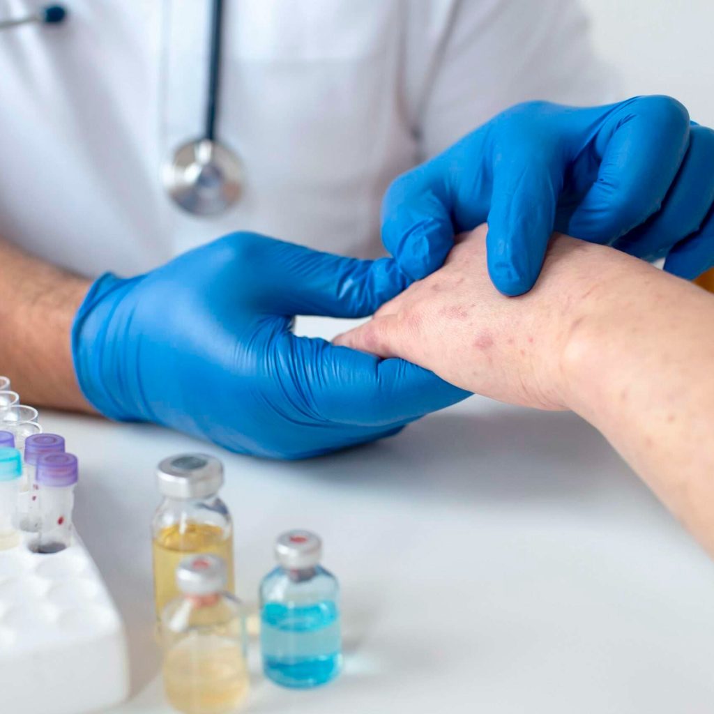 Toefx Fungal Nail Treatment: Clear, Gentle Relief Toefx Fungal Nail Treatment: Clear, Gentle Relief