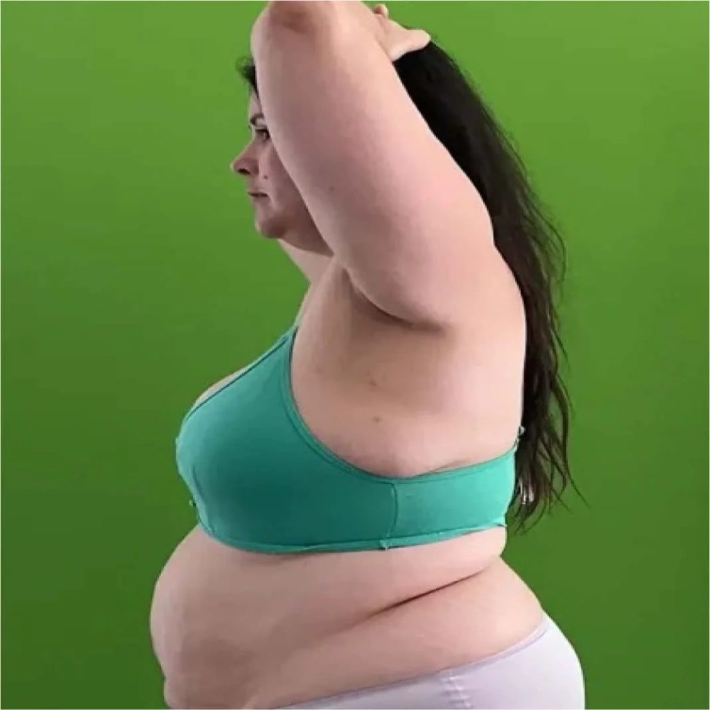 One Month On Duromine: What to Expect and Tips for Safe Results