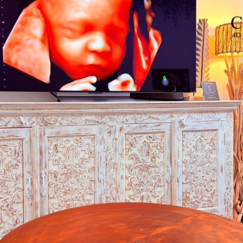 Explore Premium Prenatal Imaging in Perth