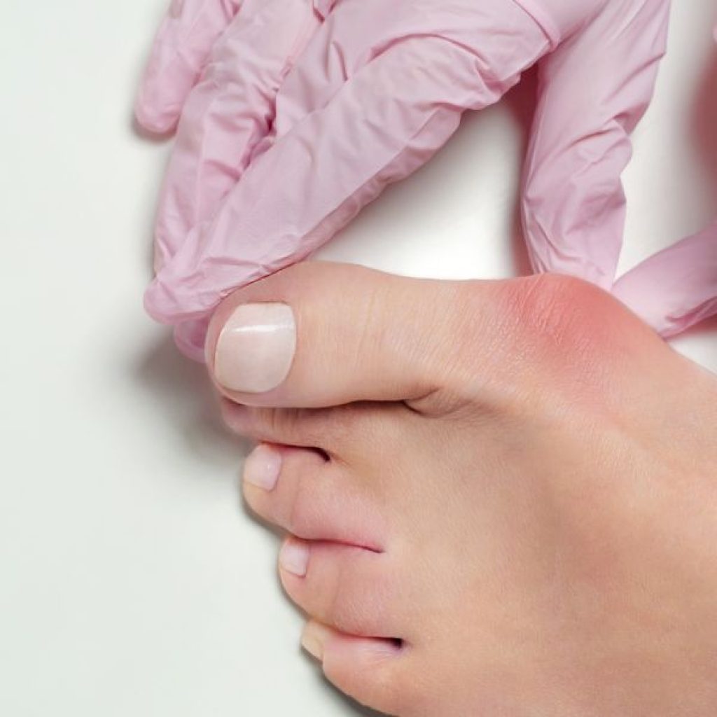 Feet Orthotics Near Me | Lmdpodiatry.com