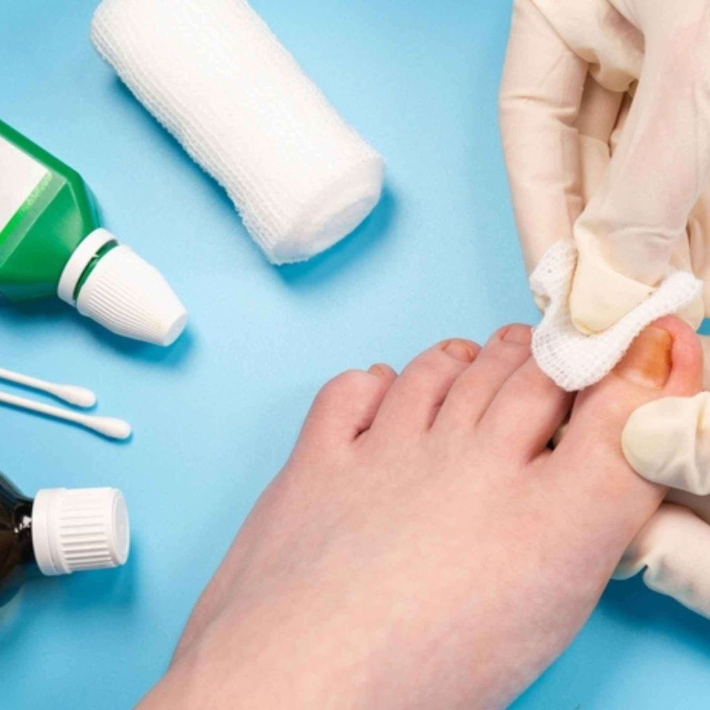 Gentle Foot Care: Remove Calluses and Corns Safely