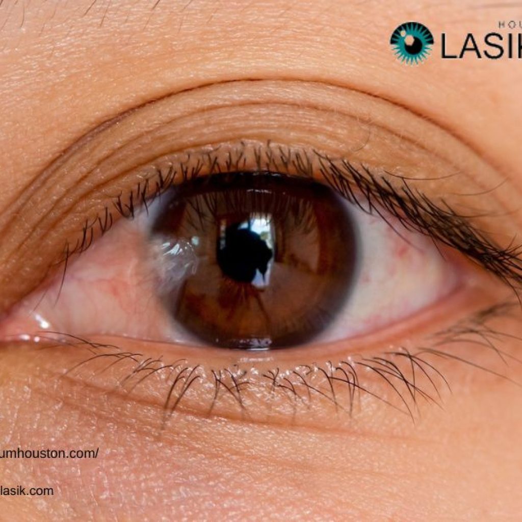 Eye Surgery Pterygium Removal | Pterygiumhouston.com