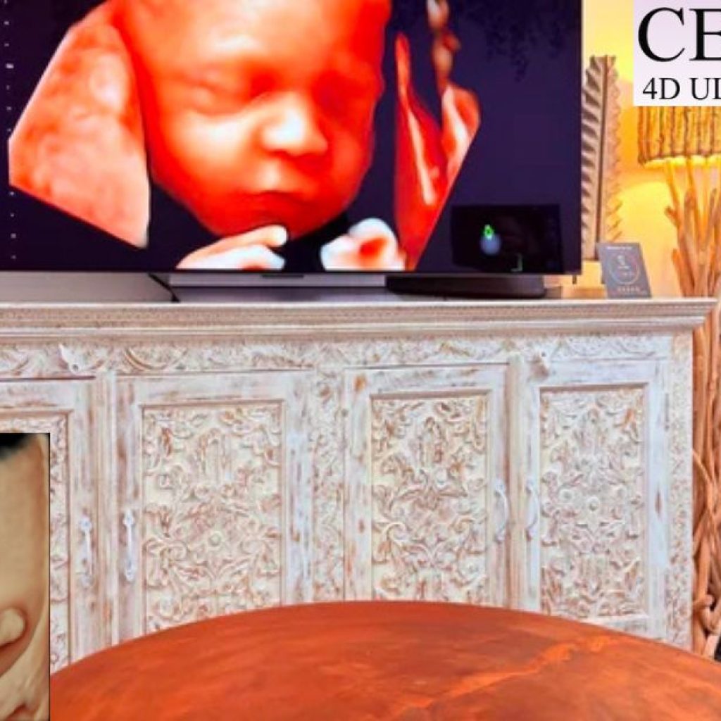 Capture Your Baby’s First Moments with a 4D Ultrasound in Perth