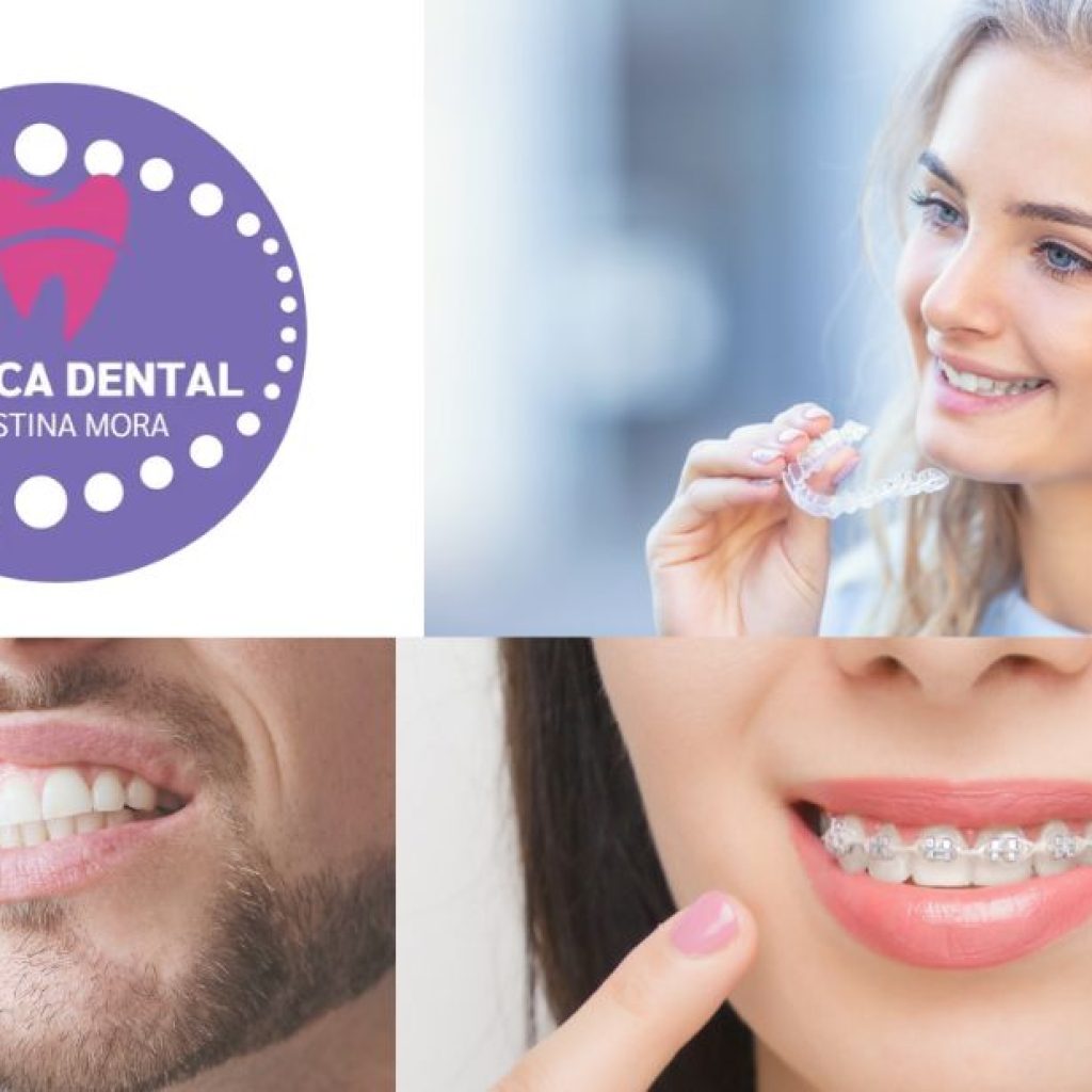 Clíniques dentals a Gines: atenció de qualitat i confiança