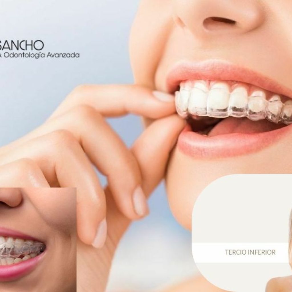 Cuida tu sonrisa en Pozuelo: prevención dental para toda la familia