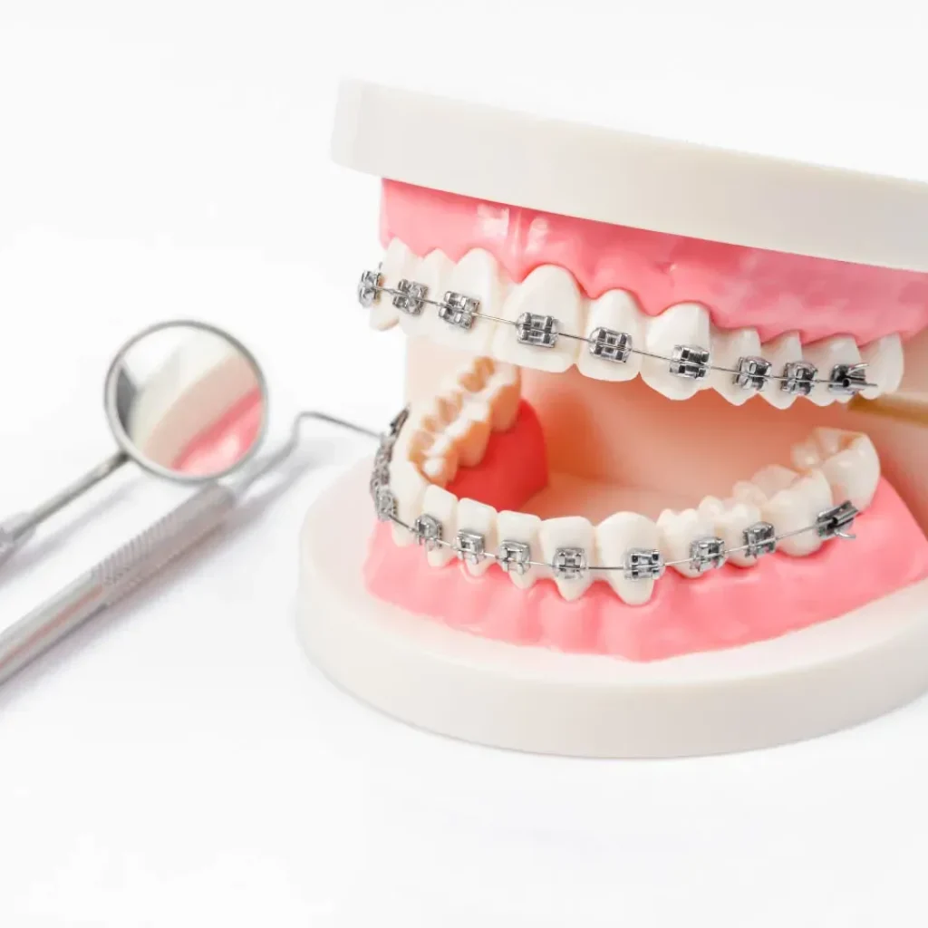 Smart Guide to Invisalign Costs and What to Expect