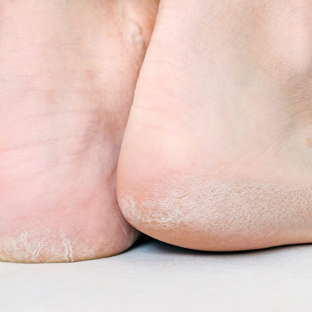 Book Your Foot Health Consultation Today