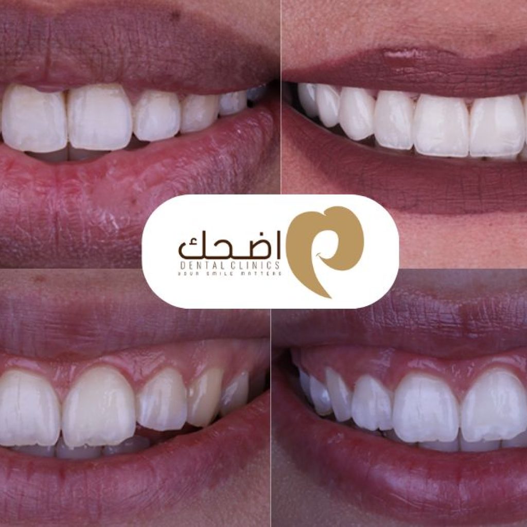 عيادات بنها للأسنان: رعاية متميزة وابتسامة صحية لك ولعائلتك
